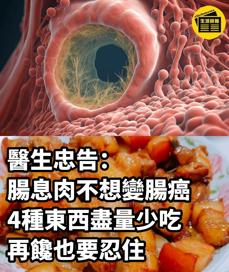 醫生忠告：腸息肉不想變腸癌，4種東西盡量少吃，再饞也要忍住