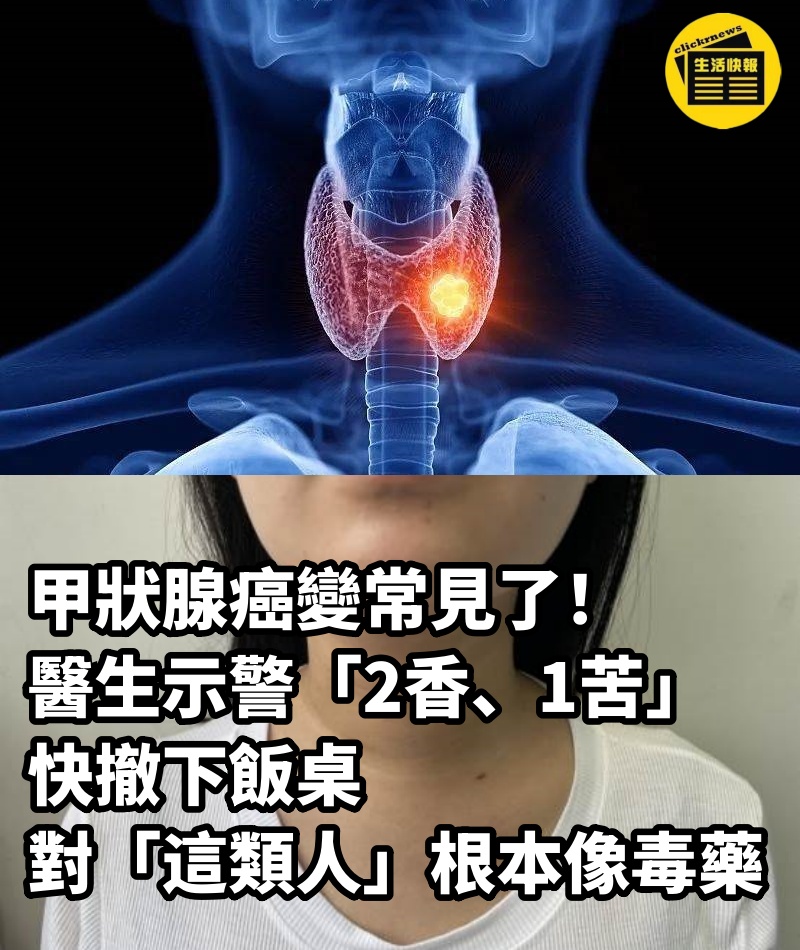 甲狀腺癌變常見了！醫生示警「2香、1苦」快撤下飯桌　對「這類人」根本像毒藥