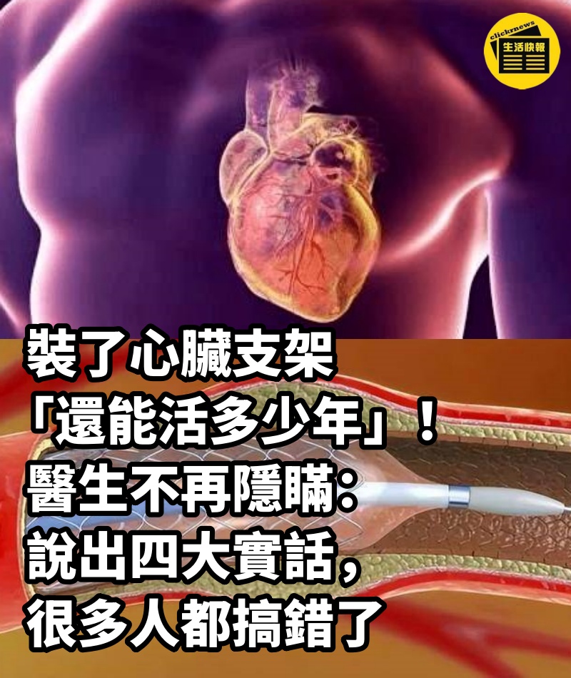 裝了心臟支架「還能活多少年」！ 醫生不再隱瞞：說出四大實話，很多人都搞錯了