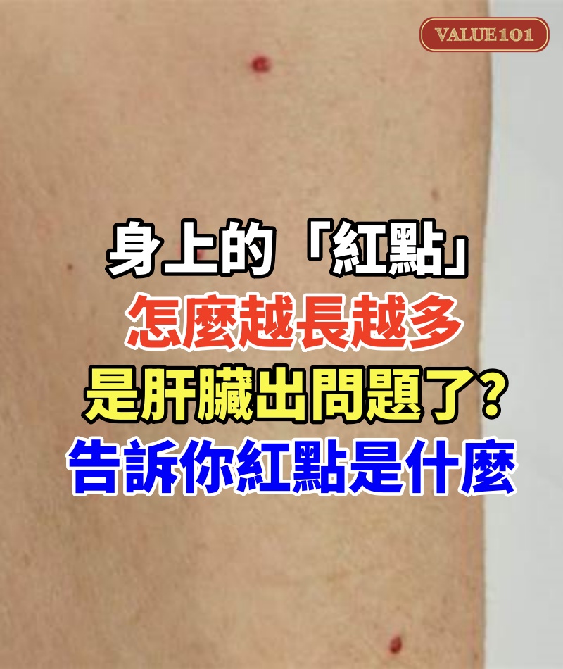 身上的「紅點」怎麼越長越多,是肝臟出問題了?告訴你紅點是什麼