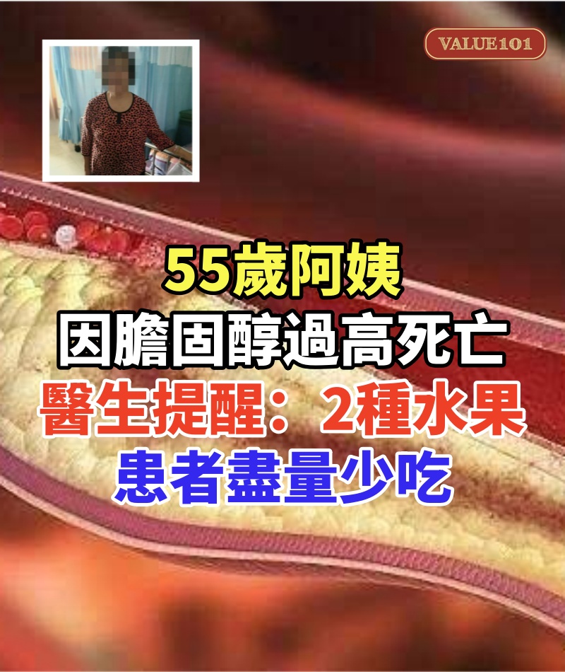 55歲阿姨因膽固醇過高死亡,醫生提醒:這2種水果,患者盡量少吃