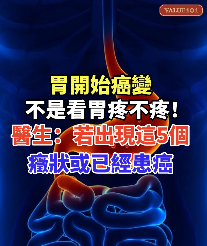 胃開始癌變,不是看胃疼不疼!醫生:若出現這5個癥狀或已經患癌