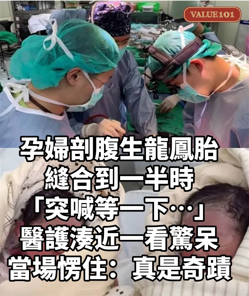 孕婦剖腹生龍鳳胎!縫合到一半時「突喊等一下…」醫護「湊近一看驚呆」當場愣住:真是奇蹟