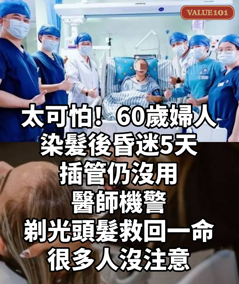 太可怕！60歲婦人「染髮後昏迷5天」插管仍沒用，醫師機警「剃光頭髮救回一命」：很多人沒注意