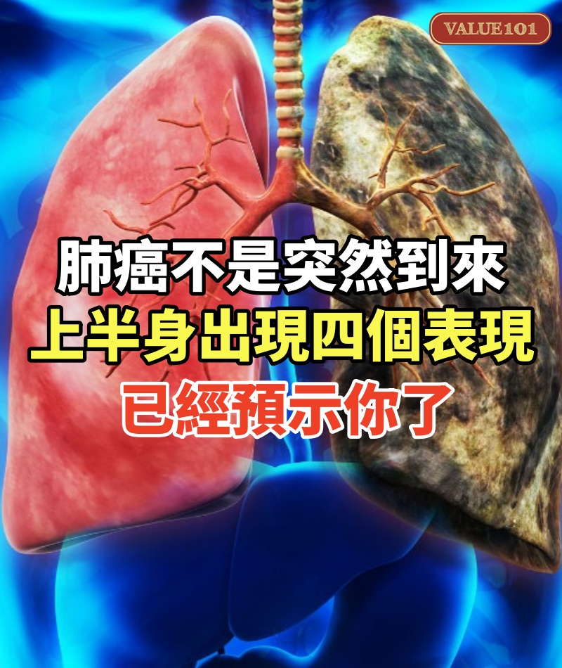 肺癌不是突然到來「上半身出現四個表現」已經預示你了