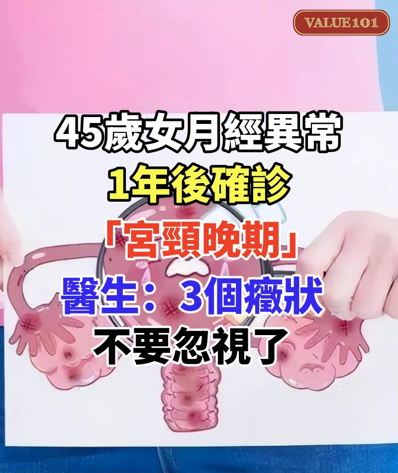 45歲女月經異常!1年後確診「宮頸晚期」,醫生提醒「3個癥狀」不要忽視了