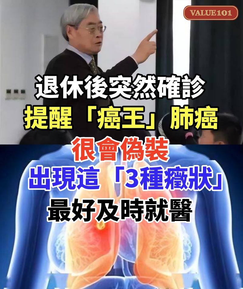 退休後突然確診!提醒「癌王」肺癌很會偽裝 出現這「3種癥狀」最好及時就醫