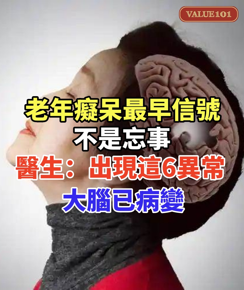 老年癡呆最早信號不是忘事!醫生:頻繁出現這6異常,大腦已病變
