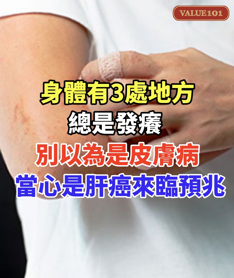 身體有3處地方總是發癢,別以為是皮膚病,當心是肝癌來臨的預兆