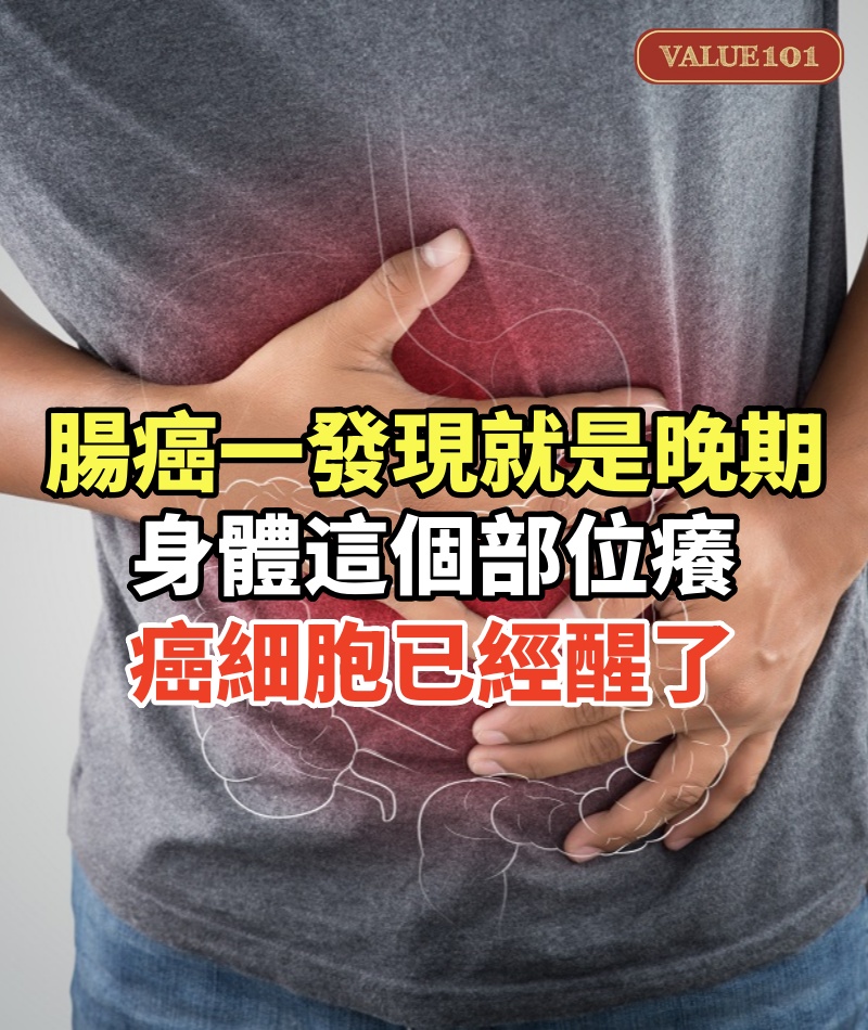 腸癌一發現就是晚期!一般身體這個部位「癢」:癌細胞已經醒了