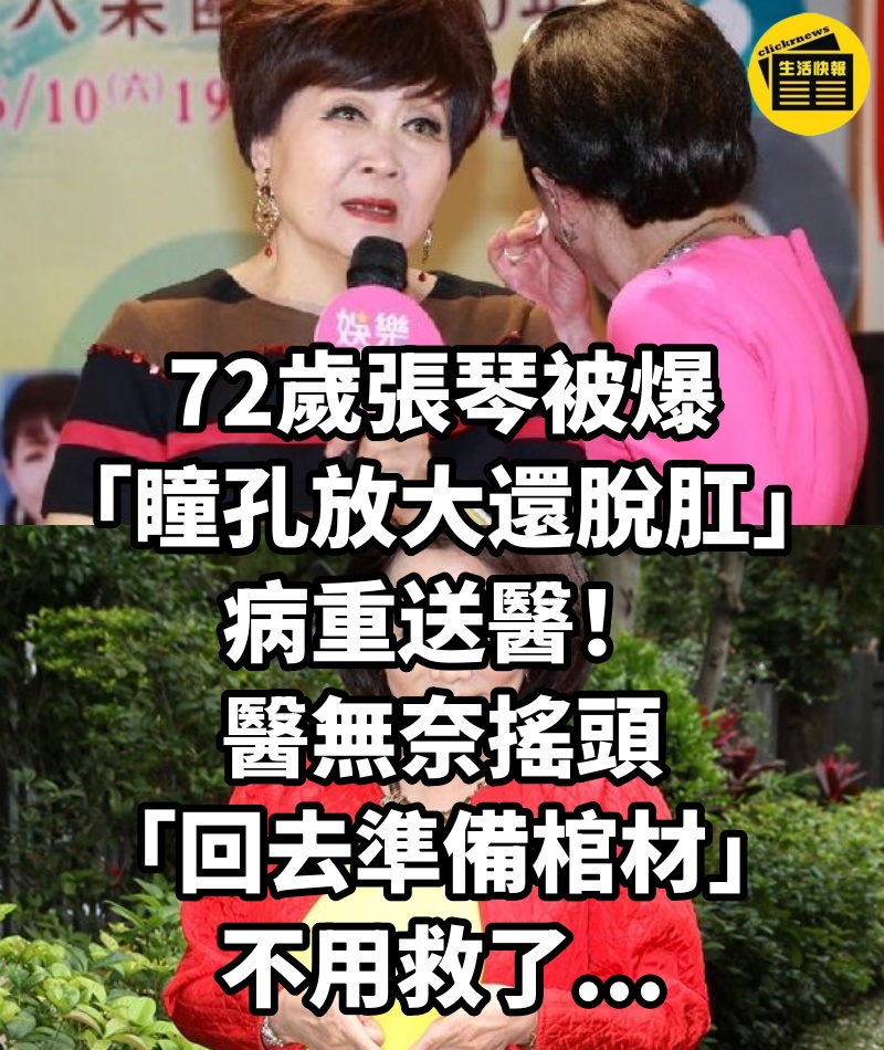 72歲張琴被爆「瞳孔放大還脫肛」病重送醫!醫無奈搖頭「回去準備棺材」:不用救了...