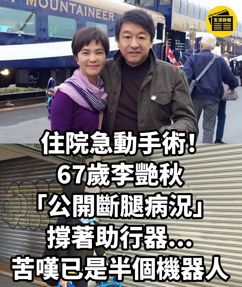 住院急動手術!67歲李艷秋「公開斷腿病況」撐著助行器...苦嘆已是半個機器人