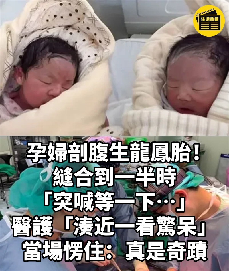 孕婦剖腹生龍鳳胎!縫合到一半時「突喊等一下…」醫護「湊近一看驚呆」當場愣住:真是奇蹟